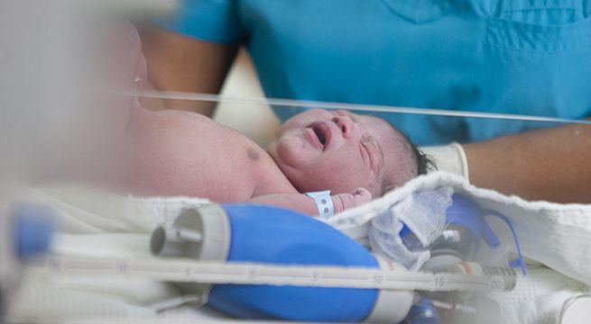 Ministerio de Salud recomienda retrasar corte del cordón umbilical en bebés durante el parto