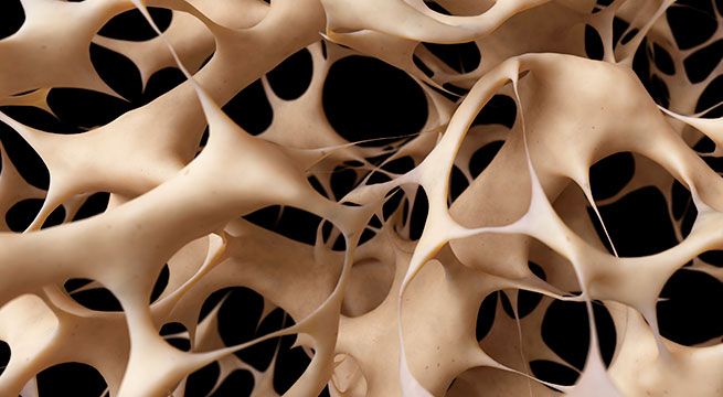 Doctor en Casa: conoce todo sobre la osteoporosis [VIDEO]