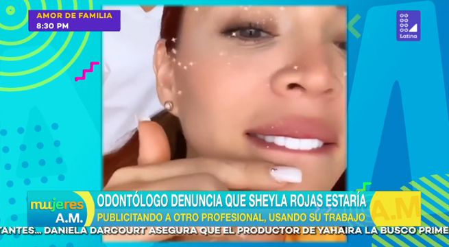Odontólogo denuncia que Sheyla Rojas publicita a otra persona con su trabajo