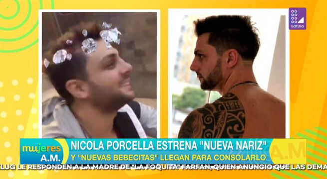 Nicola Porcella estrena nueva nariz