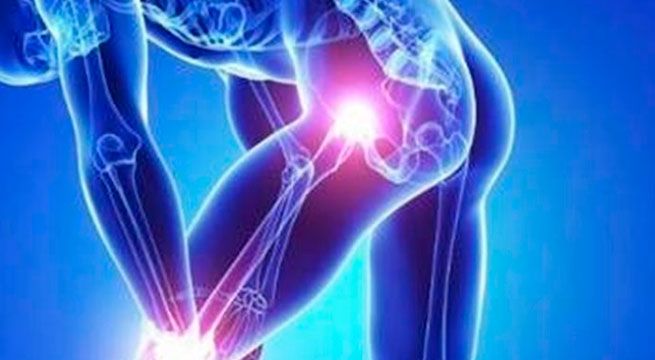 Doctor en Casa: conoce todo sobre el síndrome de Guillain-Barré