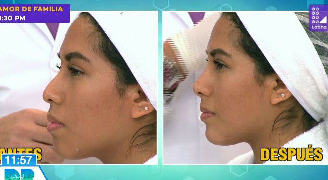 Dr. en Casa: Mira en vivo un procedimiento de perfilamiento de rostro