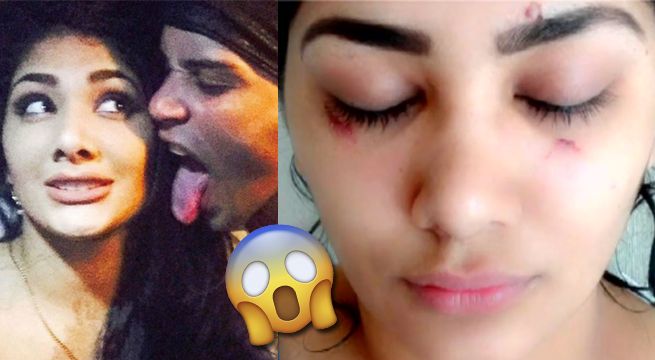 Chris Soifer reveló haber sido agredida por Jeicy durante cuatro años [VIDEO]