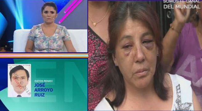 Agredió brutalmente a su expareja, pero podría ser liberado en las próximas horas