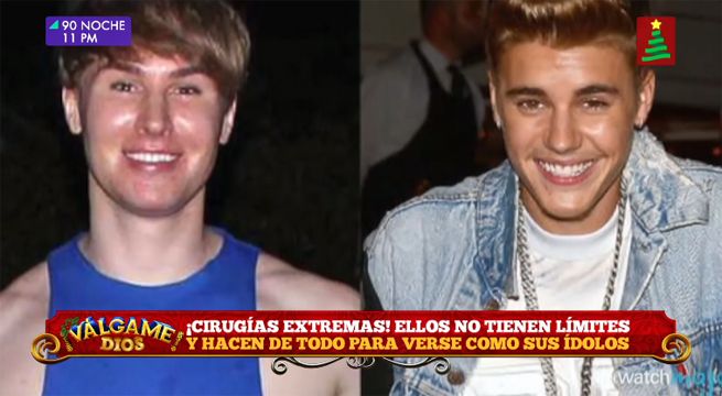 ¡Cirugías extremas!: Ellos hacen de todo para verse igual que sus ídolos