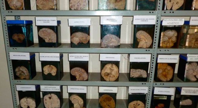 Museo del cerebro: más de tres mil cerebros en exposición