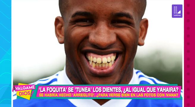 Jefferson Farfán se arregla los dientes, ¿al igual que Yahaira?