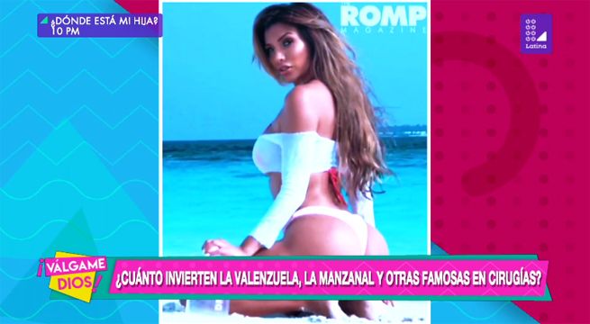 ¿Cuánto invierten la Valenzuela, la Manzanal y otras famosas en cirugías?