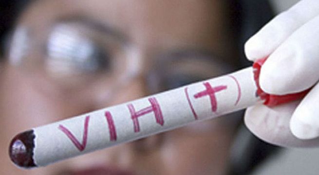 Paciente de VIH queda curado tras trasplante de células madre