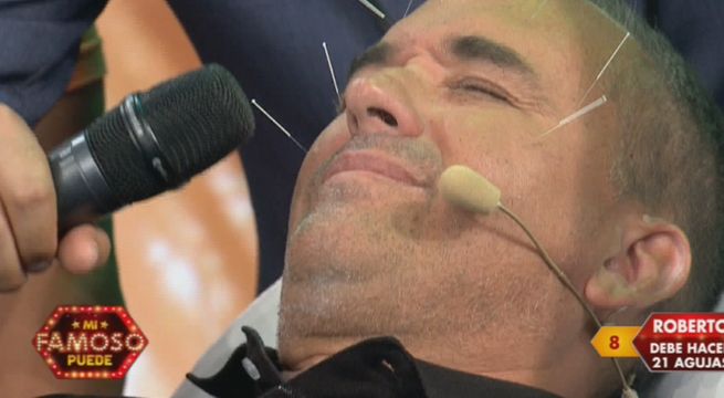 Los famosos tuvieron que aguantar muchas agujas en sus caras  