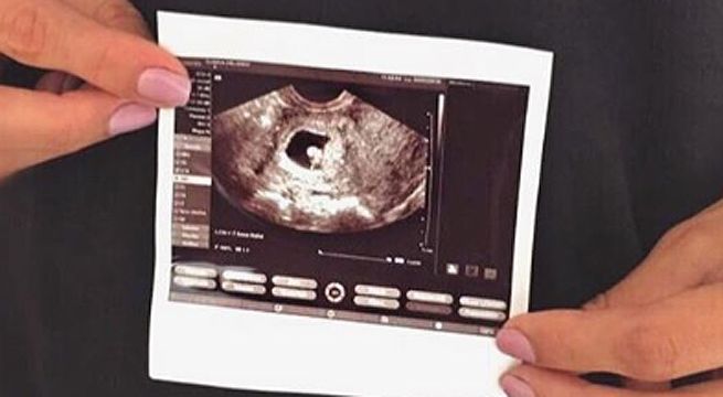 Chica reality confirmó su embarazo con mensaje en redes sociales