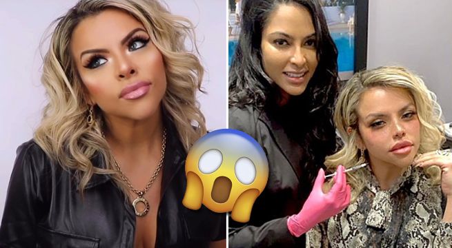 Josetty Hurtado se pone botox y la critican por sus numerosas cirugías [FOTO]