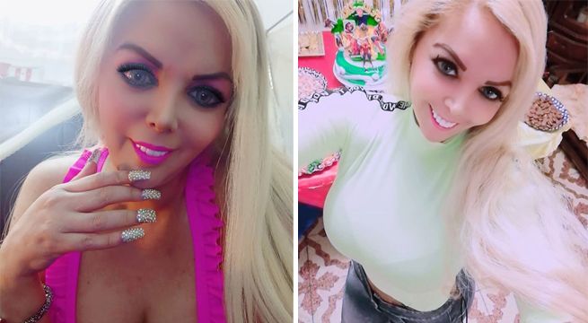 Así luce ahora Shirley Cherres tras realizarse la famosa manga gástrica [FOTOS]