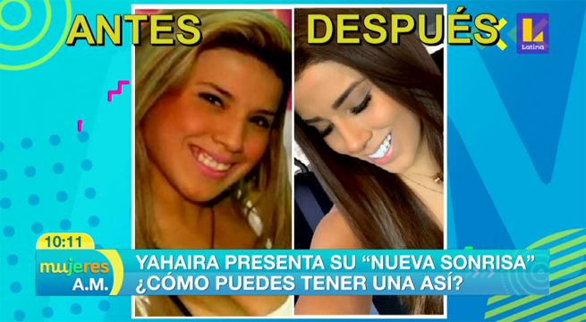 Yahaira Plasencia presenta su nueva sonrisa… ¿cómo puedes tener una así? [VIDEO]