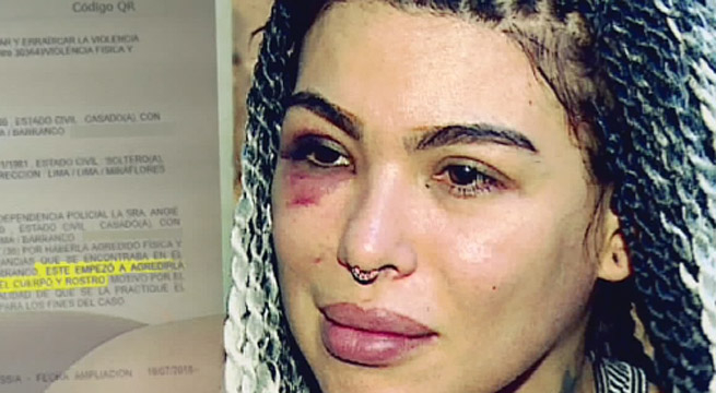 Válgame Dios: pareja de Angie Jibaja relató la brutal agresión que sufrió la modelo