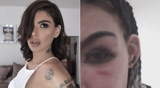 Válgame Dios: ¿Quién golpeó a Angie Jibaja?