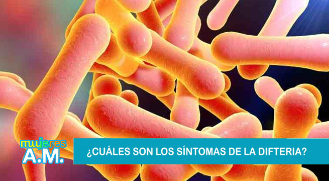 Mujeres al Mando: ¿Cuáles son los síntomas de la difteria?