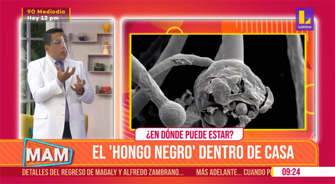 ¿Cómo el “hongo negro” puede estar en su casa?