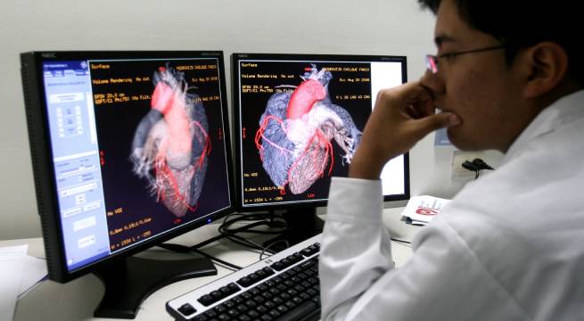 ¿Cómo identificar y prevenir enfermedades cardiovasculares?