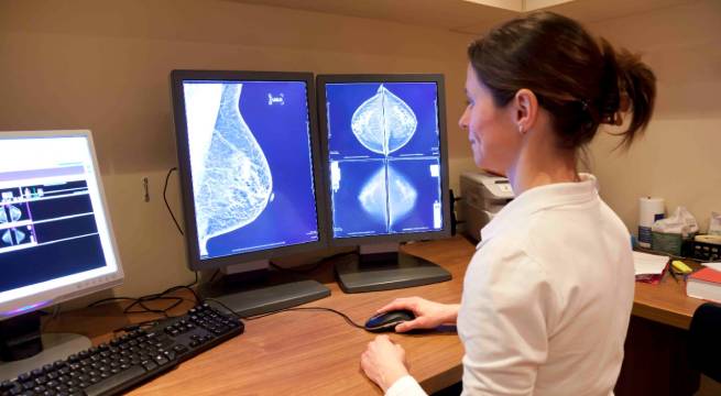 Mujeres desde los 20 años pueden tener cáncer de mama
