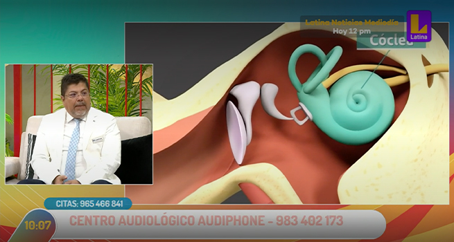 ¿Sabías que los audífonos no medicados podrían causarte molestias en tu salud?