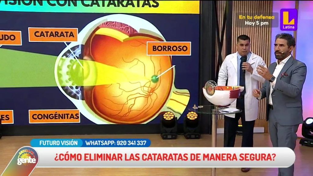 Problemas de visión: ¿Cómo eliminar las cataratas de manera segura?