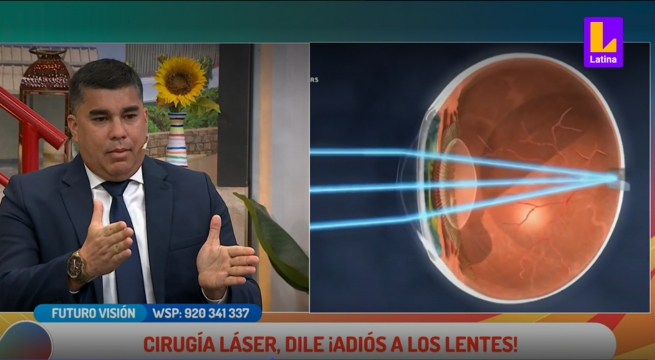 Cirugía refractiva láser: ¿Cuál es el tiempo de recuperación adecuada, tres días o dos semanas?