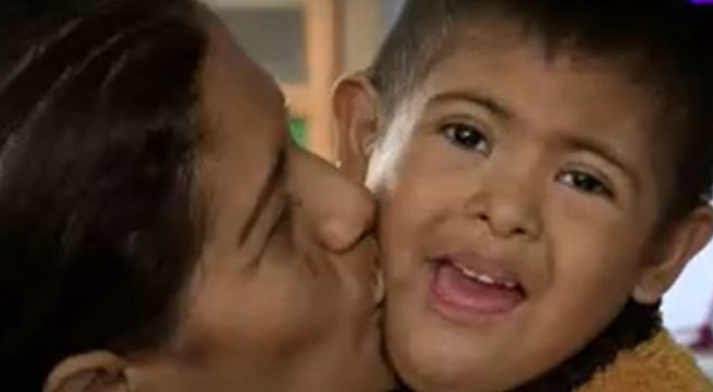 Tiene seis años, síndrome de Down y varios problemas cardiacos: madre pide apoyo con costosos tratamientos