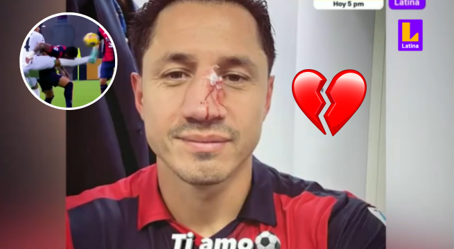 Por tercera vez rompen la nariz de Lapadula: Recuerda cómo se golpeó antes con la selección peruana
