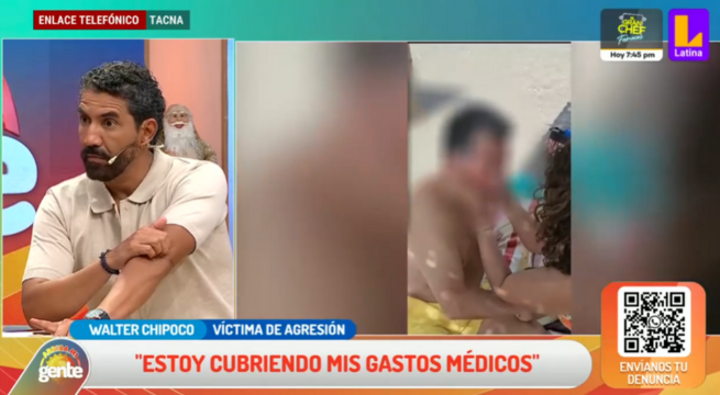 Víctima de agresión en playa de Tacna: 